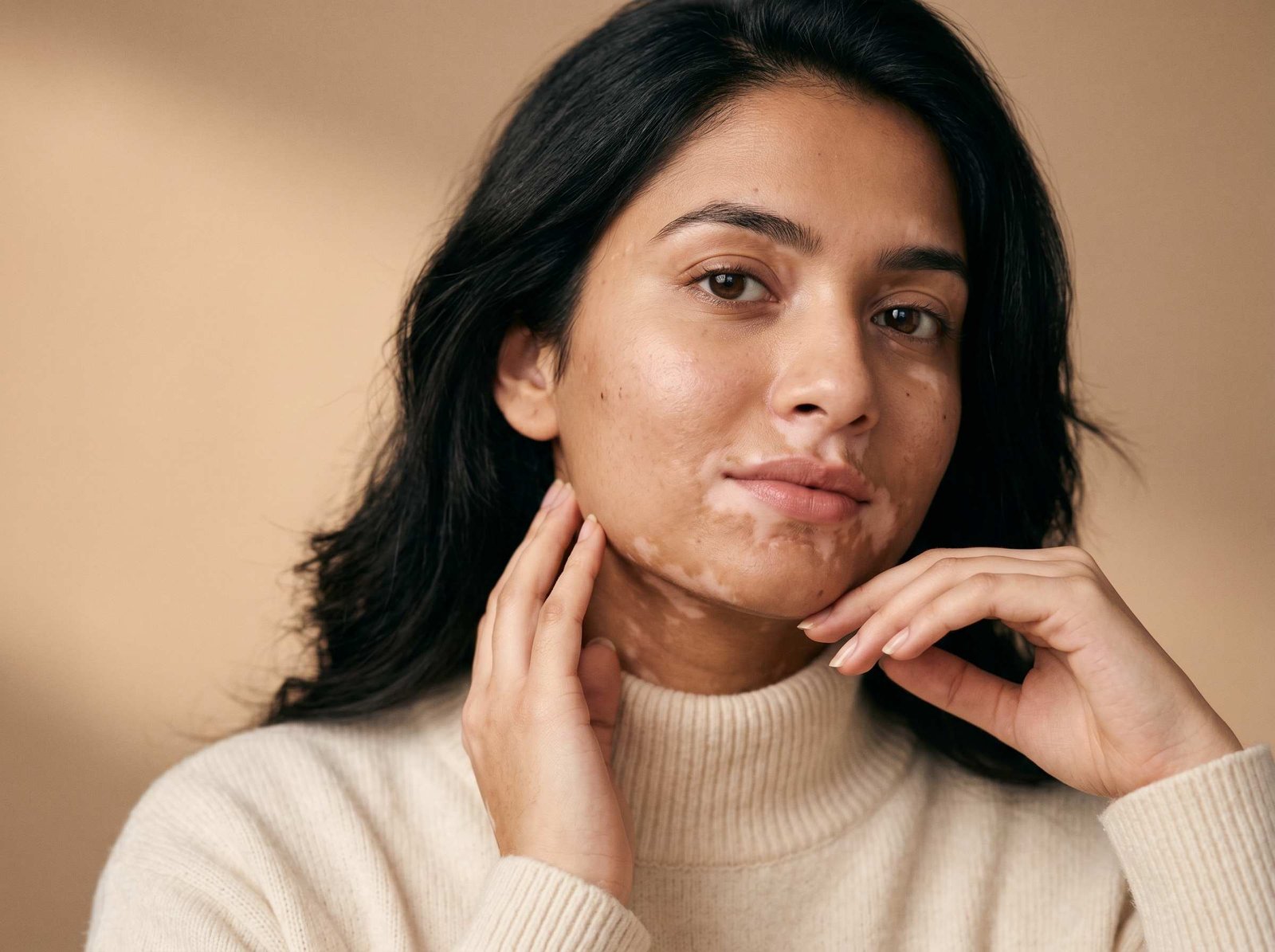 How to Care for Your Skin After a Botox Treatment