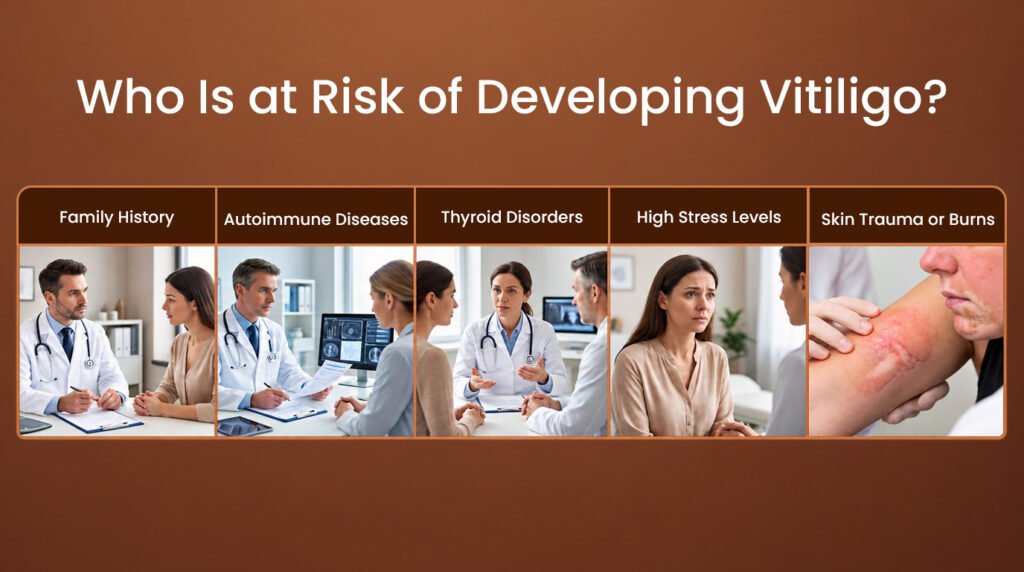 Who is at Risk of Developing Vitiligo