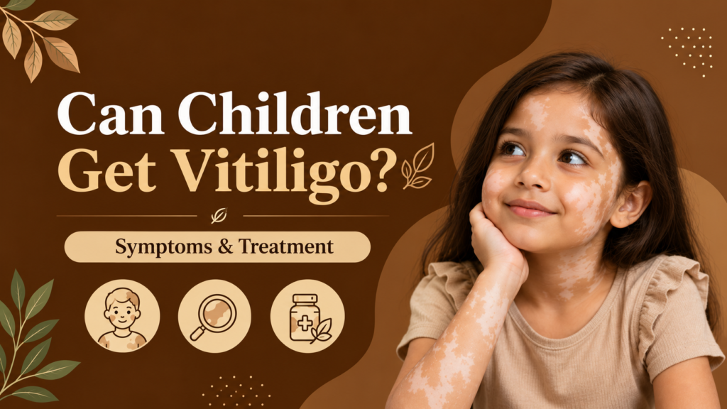 Can Children Get Vitiligo