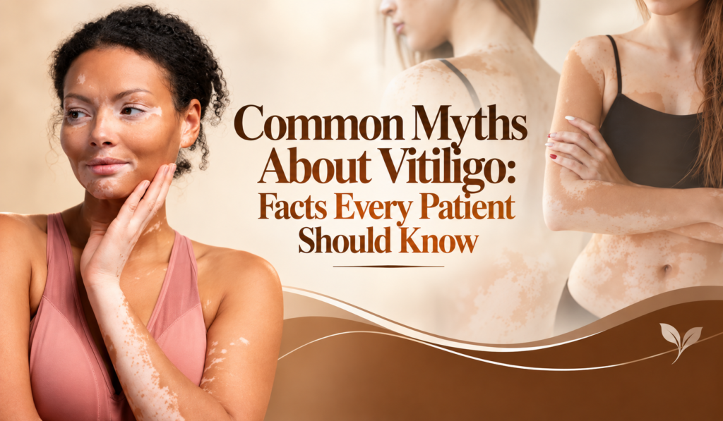 Common Myths About Vitiligo: Facts Every Patient Should Know